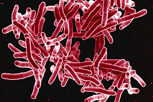 tuberculosis